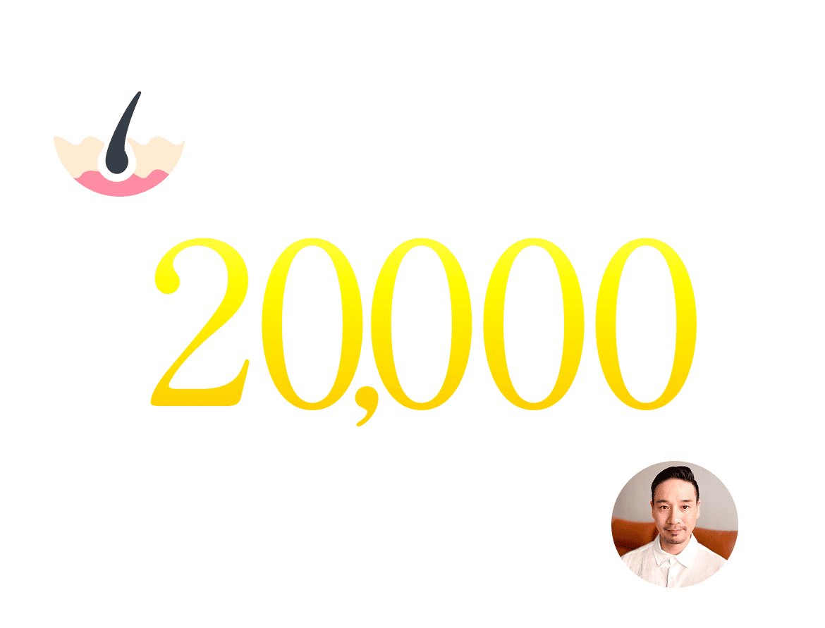 薄毛の悩みを聞いて 実績20,000人 髪の専門家が今だけ無料相談いたします！