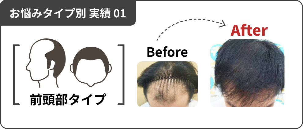 お悩みタイプ別 実績 01