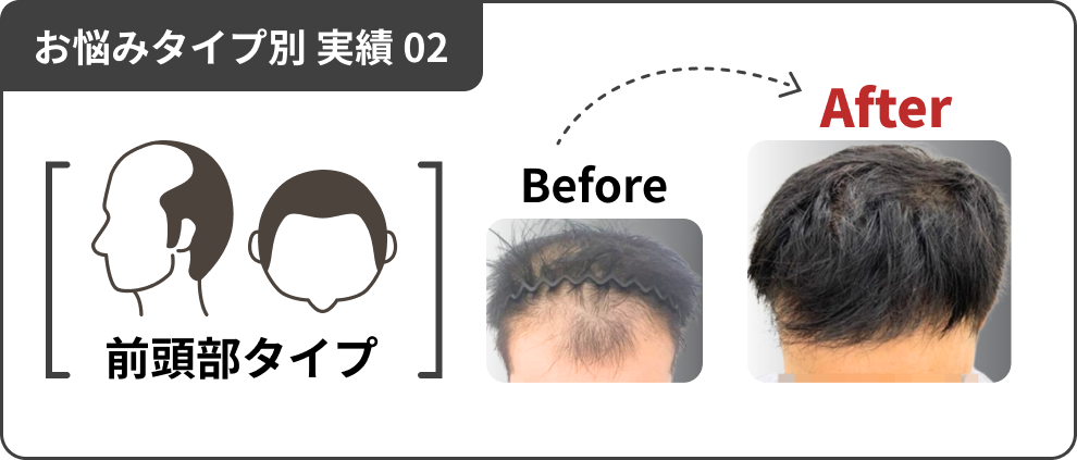 お悩みタイプ別 実績 02