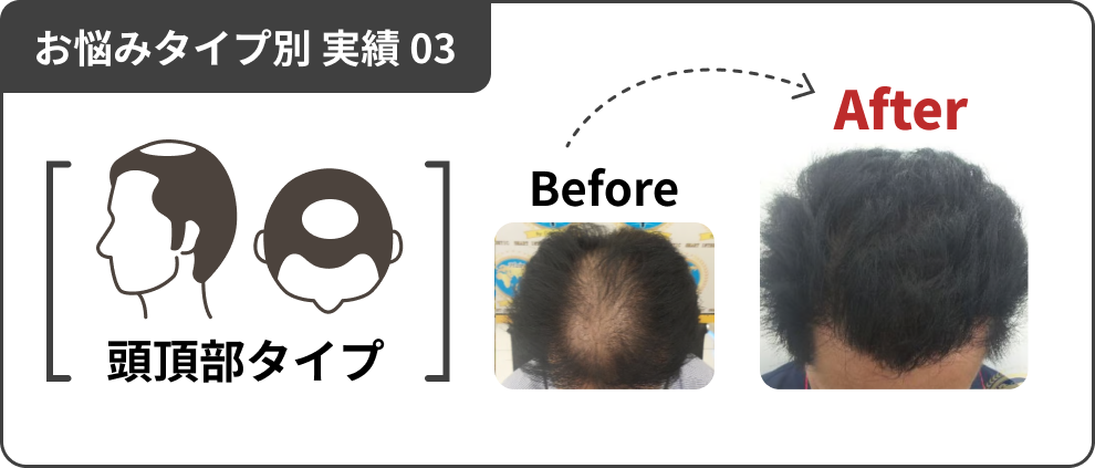 お悩みタイプ別 実績 03