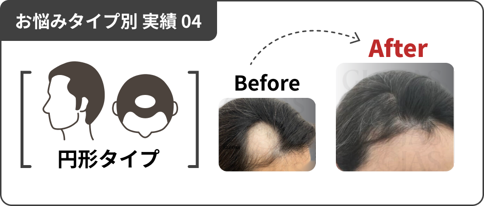 お悩みタイプ別 実績 04