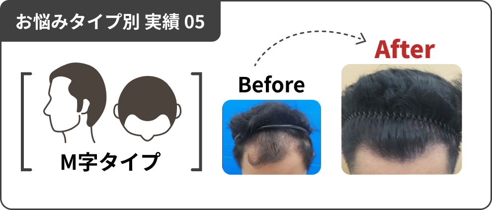 お悩みタイプ別 実績 05